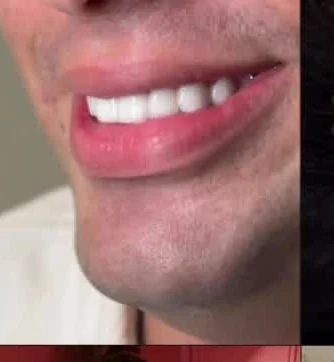 تفاصيل الابتسامة