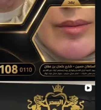 تجميل الوجه